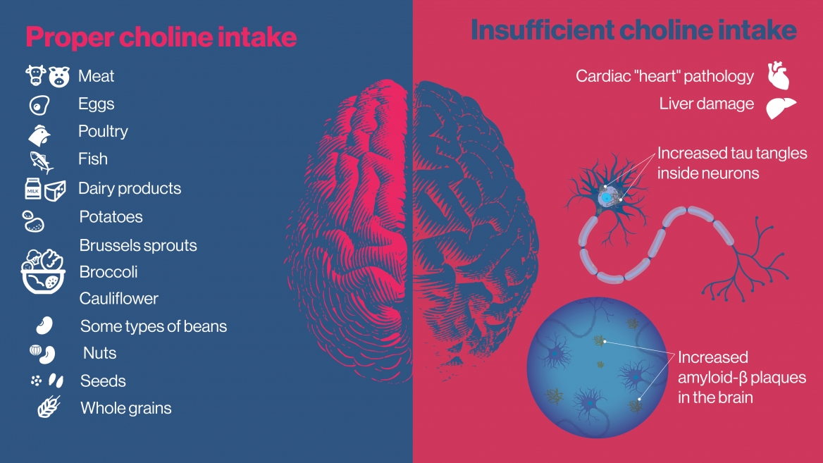 Study explores effects of dietary choline deficiency on neurologic